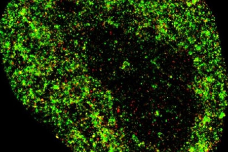 immagine del nucleo cellulare analizzato con l'IA (fonte Zhong Limei)